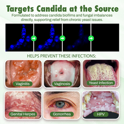 Seurico™ Oil of Oregano with Black Seed oil 2 in 1 softgels